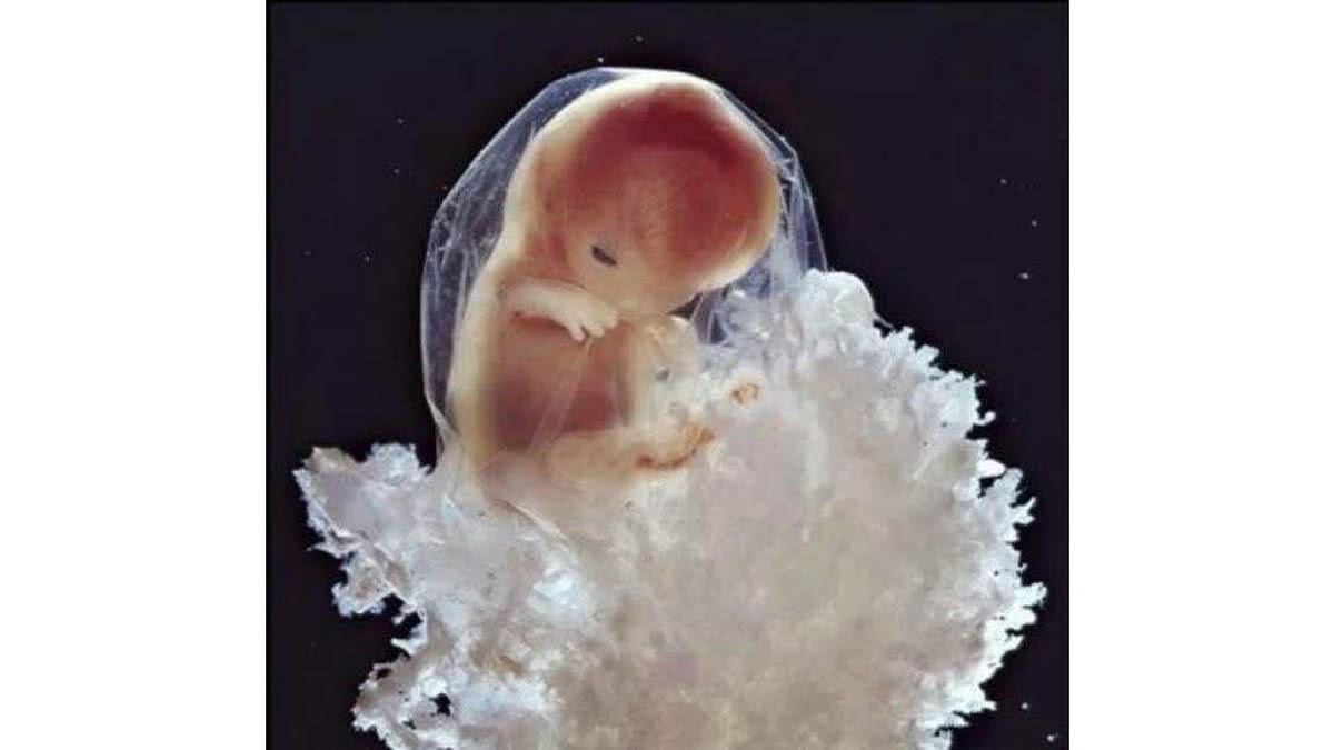 feto 1