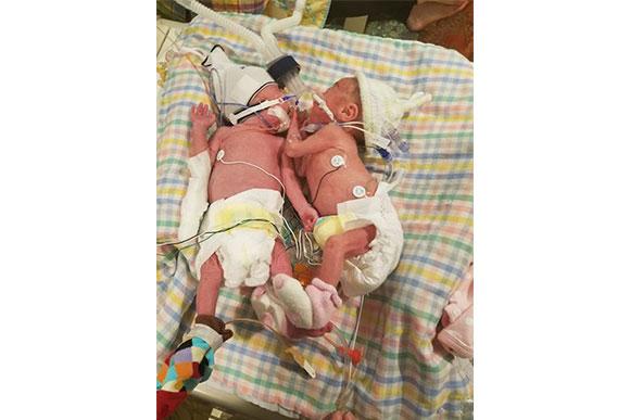 gêmeos-prematuros