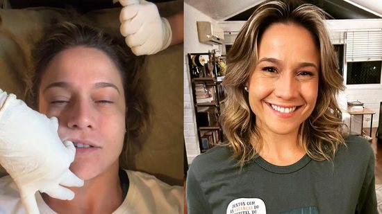 Fernanda Gentil posta stories da fisioterapia facial para tratar Paralisia de Bell - (Foto: reprodução/Instagram)