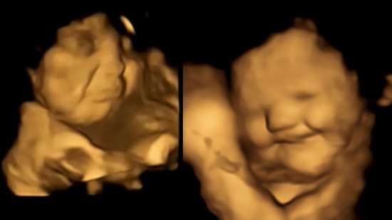 Reação do bebê ao comer cenoura - Reprodução/ Fetal and Neonatal Research Lab, Durham University