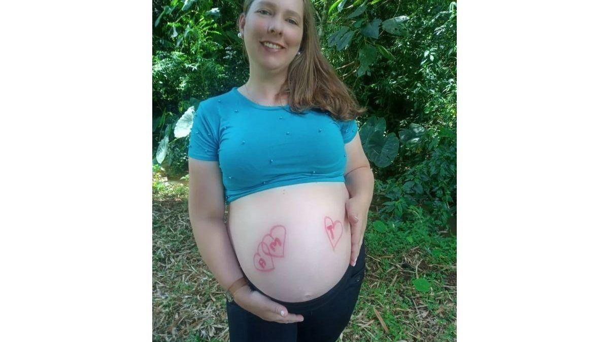Um dia após dar à luz trigêmeos a mãe foi intubada - Reprodução/ G1
