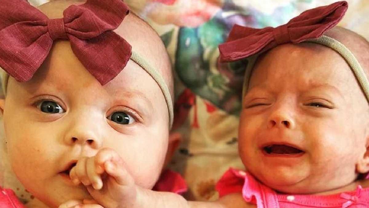 Gêmea nasce com o triplo do tamanho da irmã e mãe conta história de superação - reprodução/Instagram/@laudrieanna