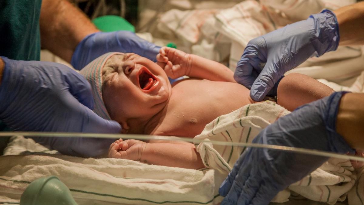 Bebê teve complicações na circuncisão / Imagem ilustrativa - Reprodução /GettyImages