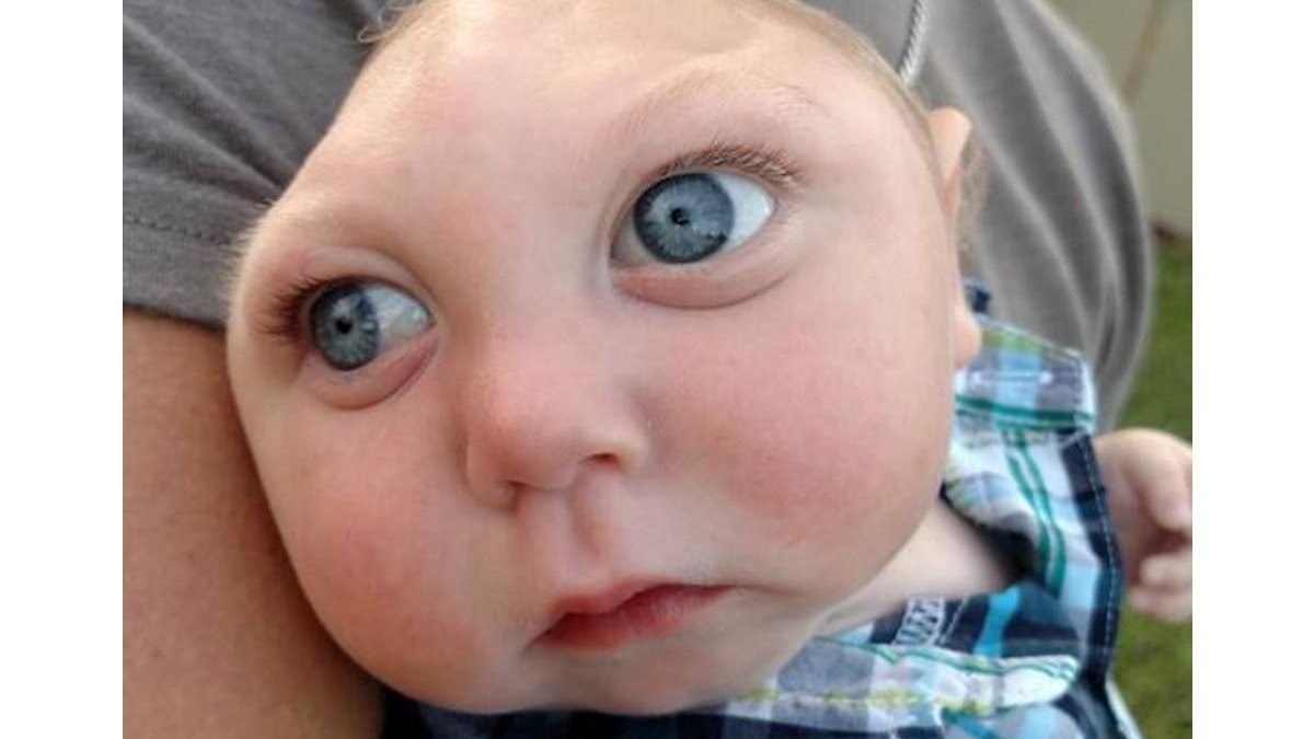 O americano Jaxon Buell nasceu com apenas 20% do cérebro desenvolvido, ele faleceu recentemente com 5 anos de idade - Getty Images