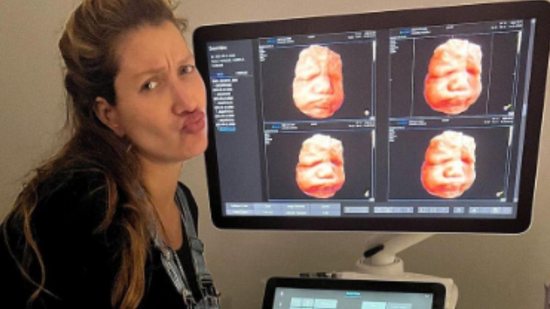 Gabriela Pugliesi vê rosto do primeiro filho em ultrassom - Reprodução/Instagram/@eusougabriela