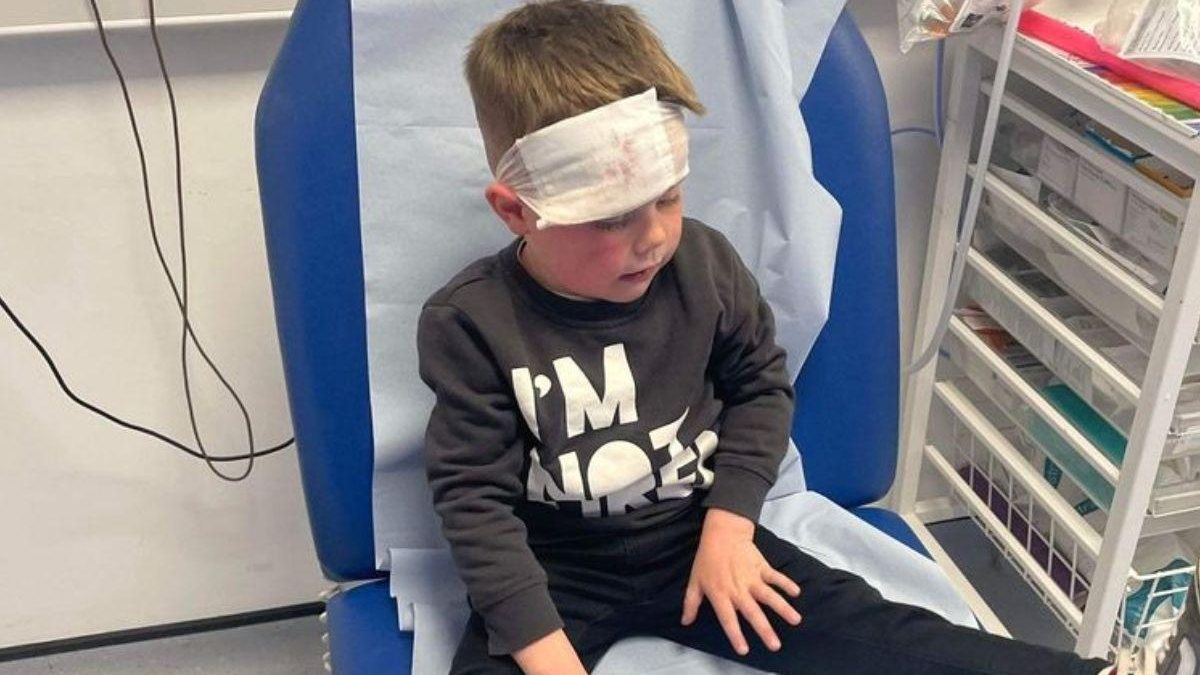 O menino ficou com machucados no rosto após ser atropelado por ciclista - Reprodução/ Georgia Havard