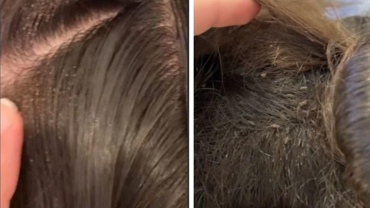 A cabeleireira sugeriu que os pais raspassem a cabeça da criança - Getty Images