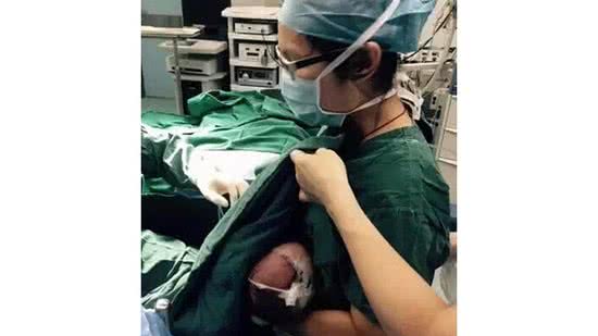 Enfermeira amamenta na China 1 - Li Baoxia amamentou a menina até o fim da cirurgia