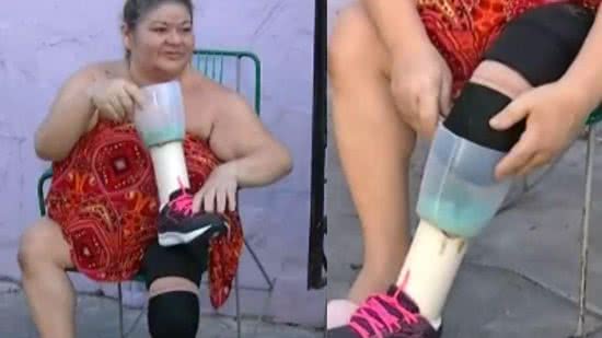 Mulher usa liquidificador como prótese após amputar a perna - Reprodução/ Rede Globo