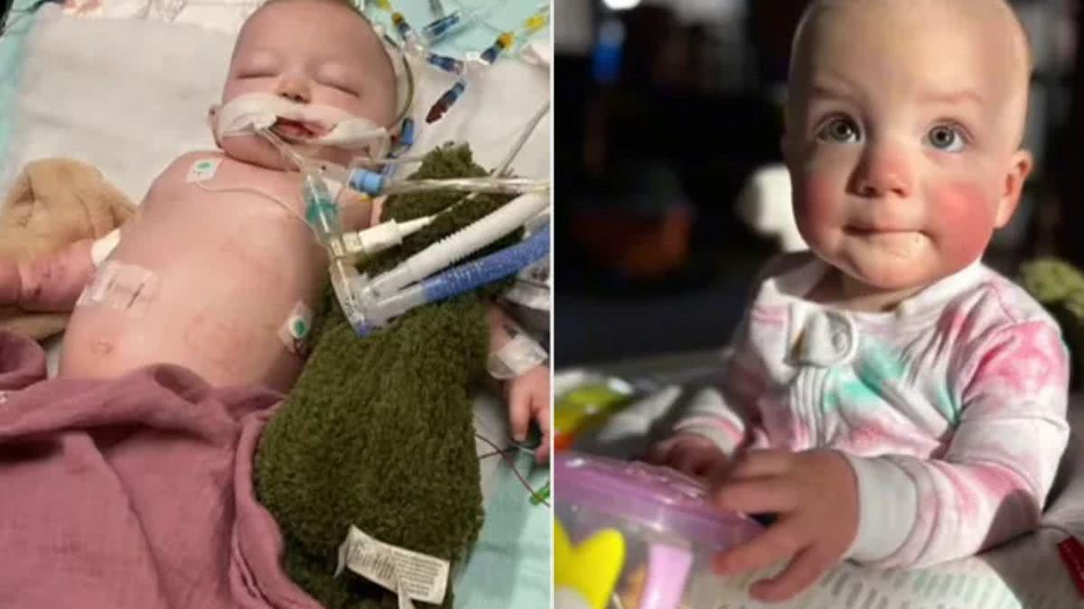 Bebê engole pacote de bolinhas e passa 4 meses no hospital - Arquivo Pessoal Fohlicia Mitchell 