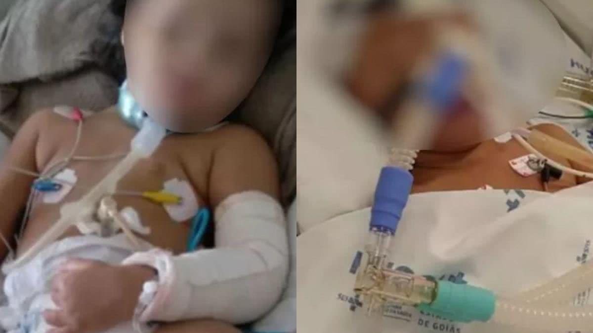 Justiça condenada padrasto e mãe deixarem criança de 3 anos em estado vegetativo - Reprodução G1