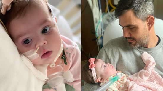 Maria Guilhermina, filha de Juliano Cazarré, passou por uma traqueostomia com poucos meses de vida - Reprodução/Instagram