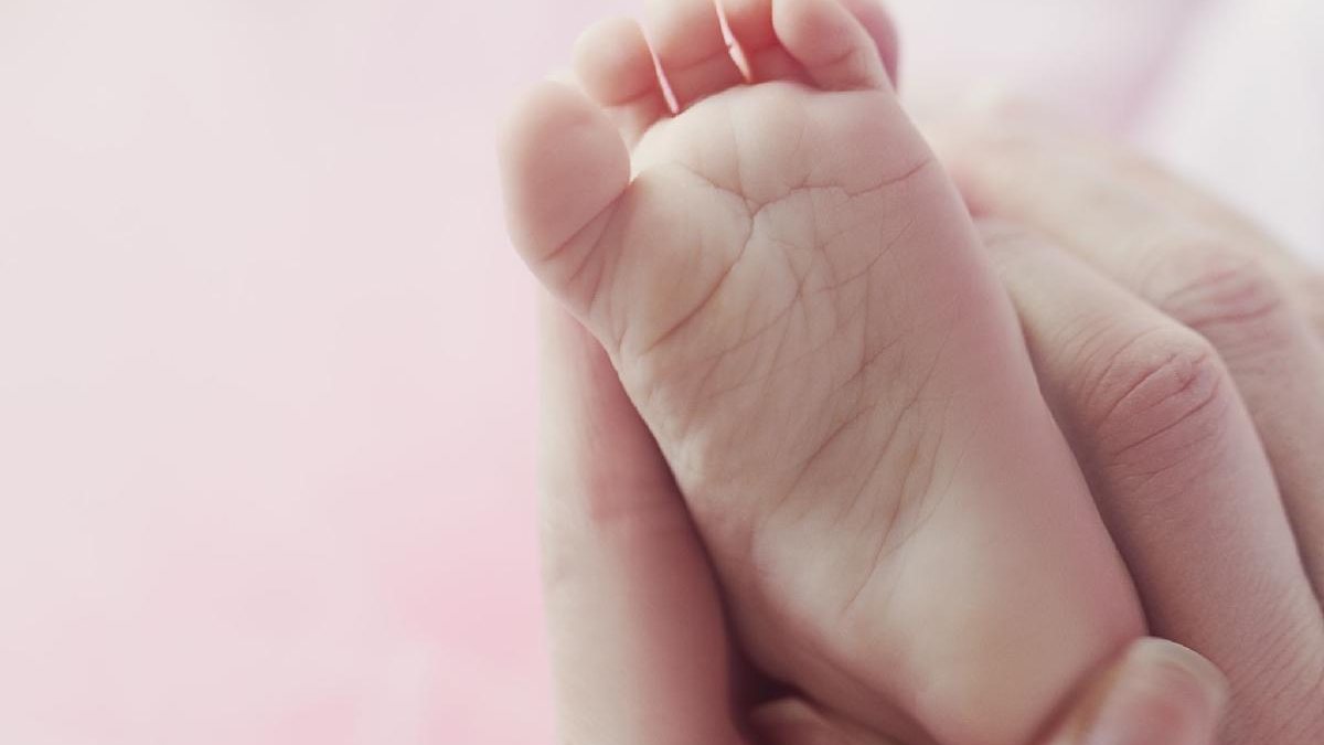 Os pais devem ficar de olho na pele do bebê - Getty Images