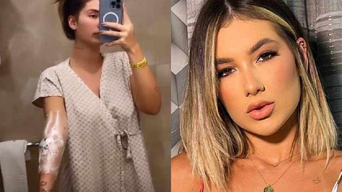 Virginia Fonseca dá entrada em hospital devido a enxaqueca - reprodução Instagram