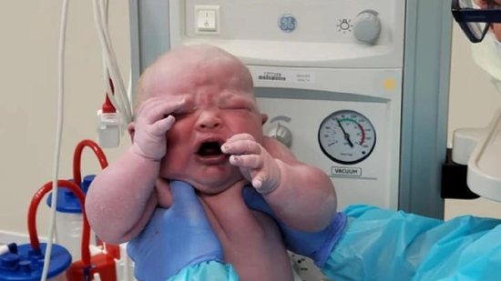 Uma mãe falou sobre a experiência ao dar à luz bebê com mais de 6 kg - reprodução/Facebook/Cary Patonai