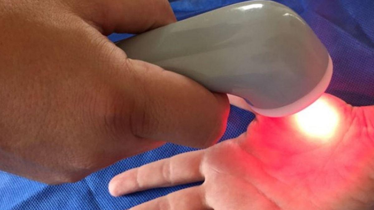 Demonstração do aparelho que une ultrassom e laser para controlar as dores da fibromialgia (foto: reprodução/Facebook)