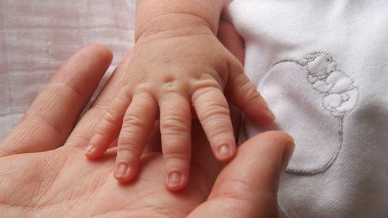 Como incentivar o bebê a ter uma soneca mais tranquila - Lexi Robins é portador de uma doença rara que transforma os músculos, ligamentos e tendões em ossos  (FOTO: Getty Images)