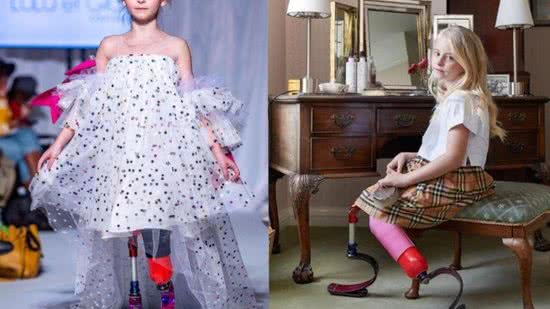Menina de 9 anos com próteses arrasa nas passarelas - Reprodução/Instagram