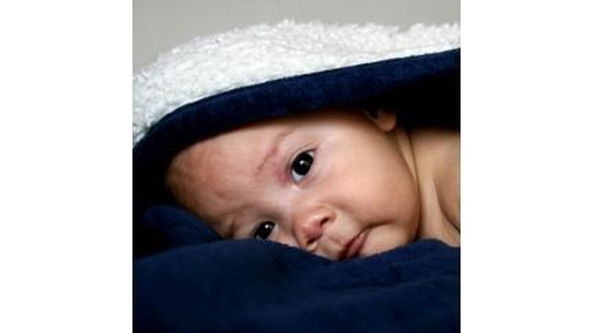 Imagem Como cuidar e evitar doenças da cabeça dos bebês