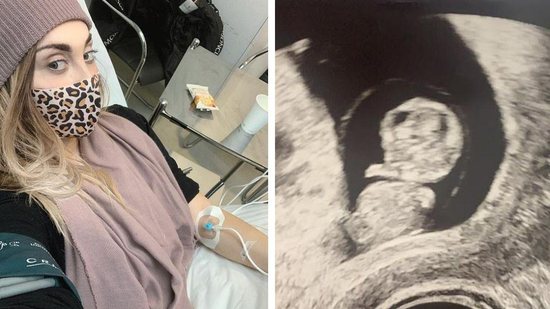 Grávida de gêmeos, mãe faz desabafo sobre aborto espontâneo de um dos bebês - Reprodução / DailyMail