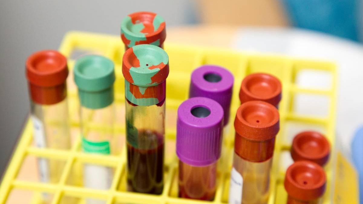 Pesquisa chinesa relacionou o tipo sanguíneo de pessoas infectadas com o novo coronavírus - Unsplash
