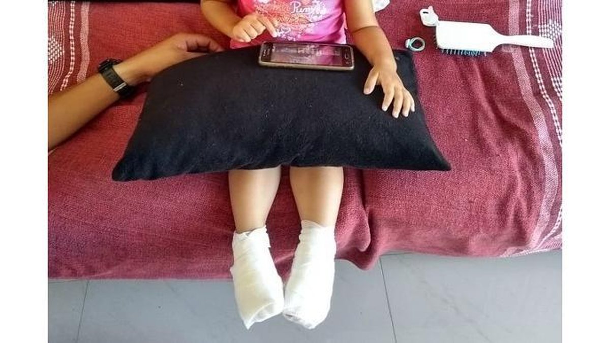 A menina de dois anos teve queimaduras de segundo grau nos pés - reprodução/ Instagram