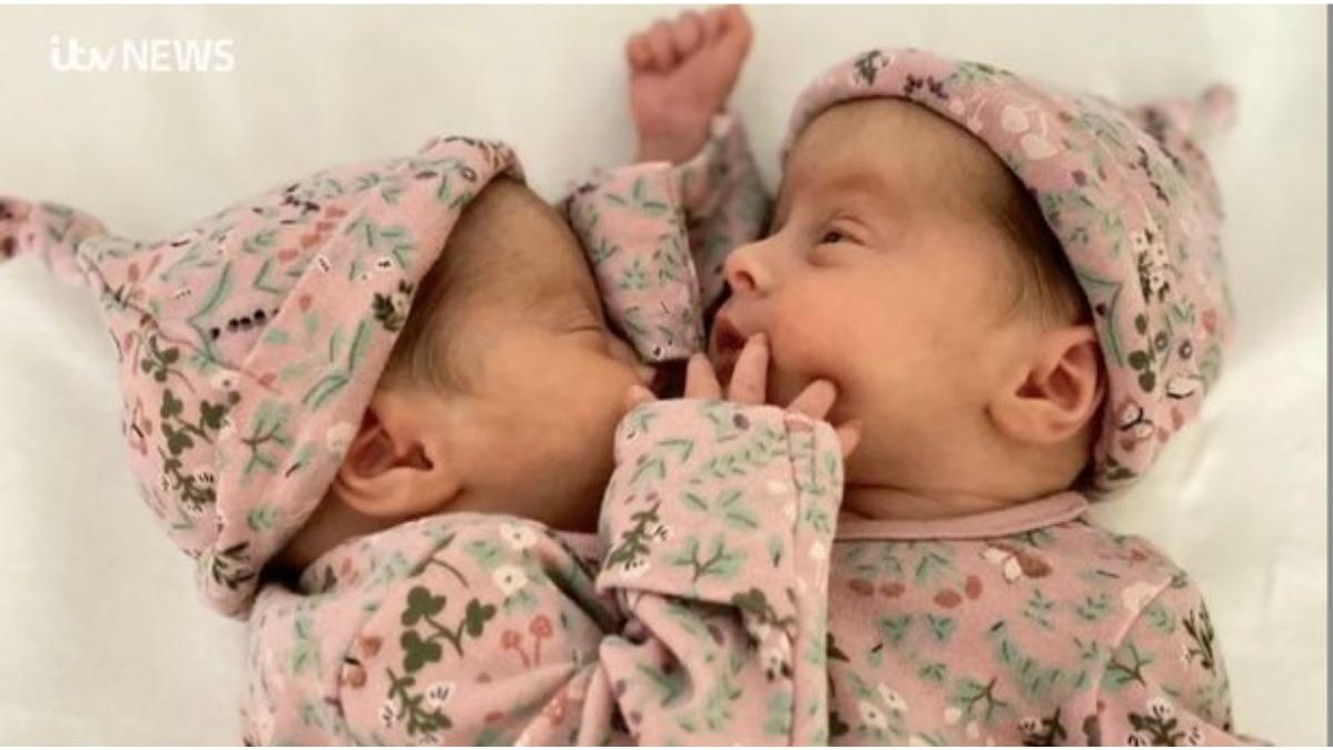 O casal Hannah e Dan Bateson comenta sobre filhas gêmeas siameses - Reprodução/ITV