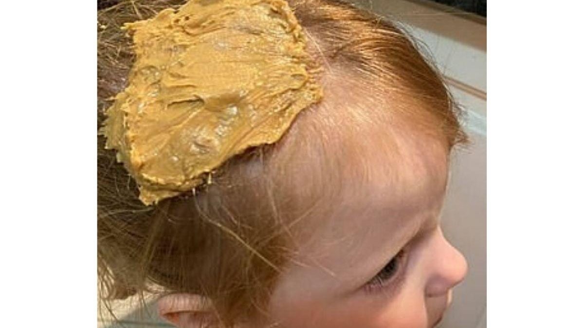 Sem desespero! Mãe descobre forma fácil e rápida de tirar chiclete do cabelo da filha - Getty Images