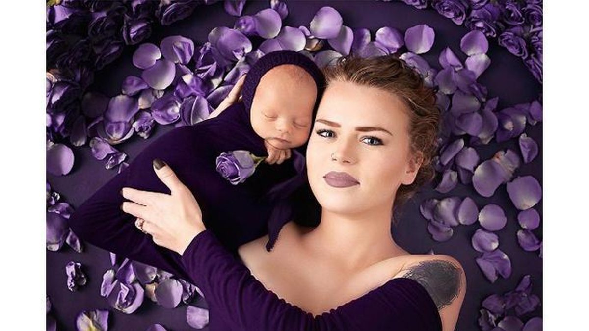 Mackenzie conseguiu dar à luz apesar de ter fibrose cística - Reprodução / Instagram @tararubyphotography
