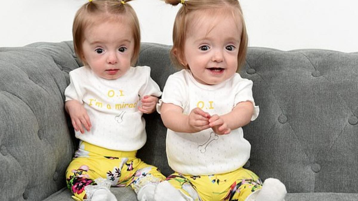 Os gêmeos junto aos pais e a irmã - Reprodução / DailyMain