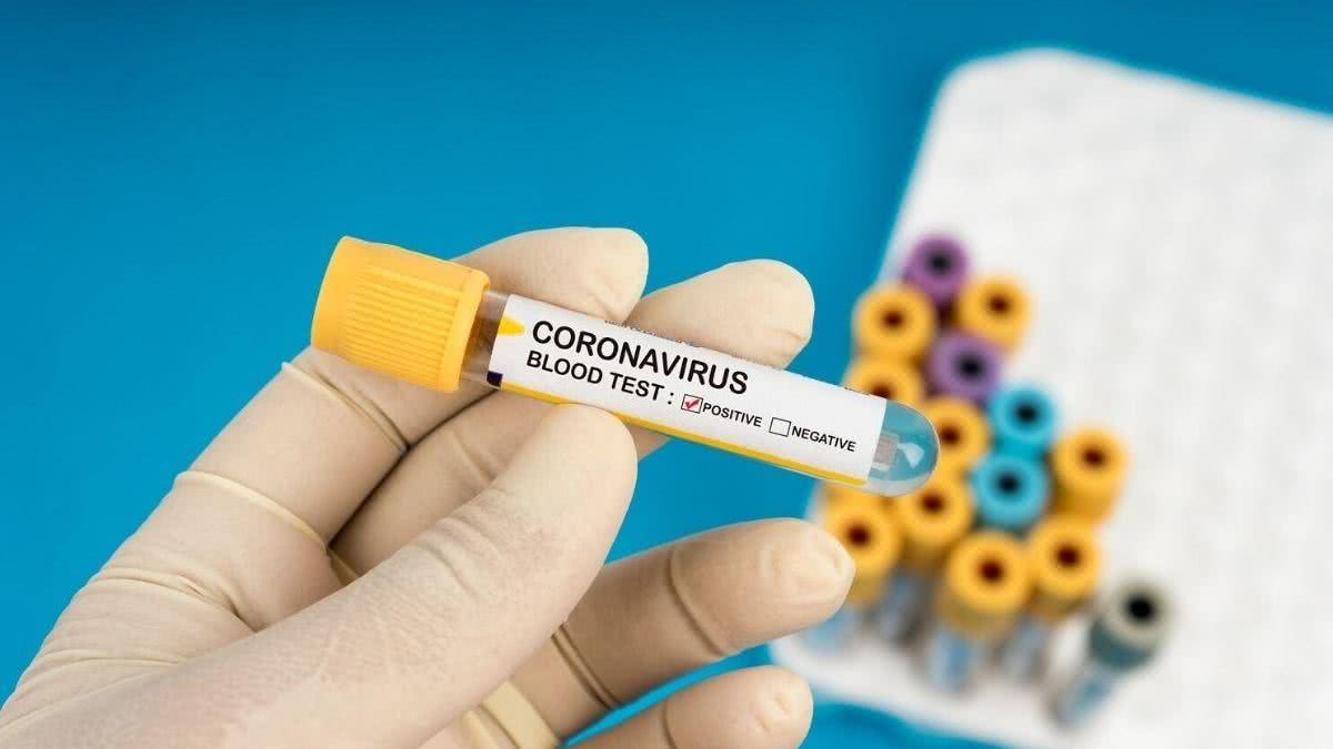 A pandemia de coronavírus foi anunciada no mundo em 11 de março de 2020 - Getty Images