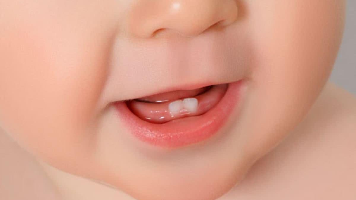 Veja dicas de como enfrentar o período da primeira dentição do bebê - Getty Images