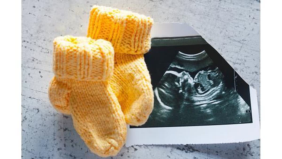 Os abortos são comuns em ao menos 20% das mulheres - Getty Images