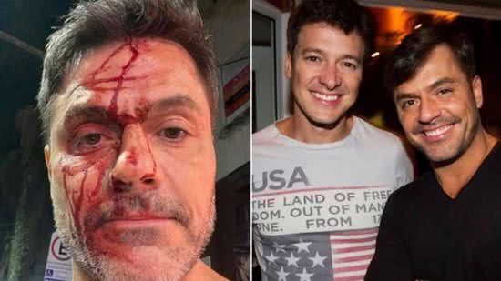 Irmão de Rodrigo Faro após acidente de carro - Reprodução/Instagram @danilofaro