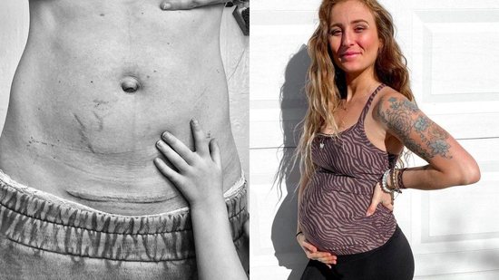 Mãe faz desabafo sobre parto cesárea e apoia outras mulheres - Reprodução / Instagram / @movewithtruelove