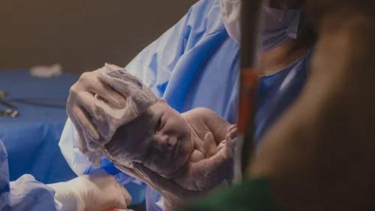 Mãe descobre que objeto cirúrgico “do tamanho de um prato” foi esquecido no seu corpo após parto - Reprodução/Pexels