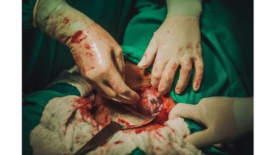 Miguel aparece com a mão para fora antes de ser tirado da barriga da mãe - reprodução/Instagram