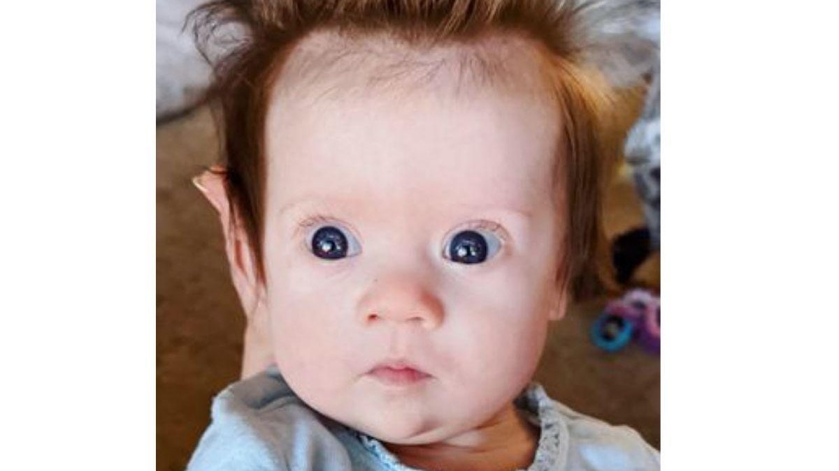 Menina de 4 meses chama atenção pelo tamanho do topete: “Parece o Jimmy Neutron” - reprodução Mirror