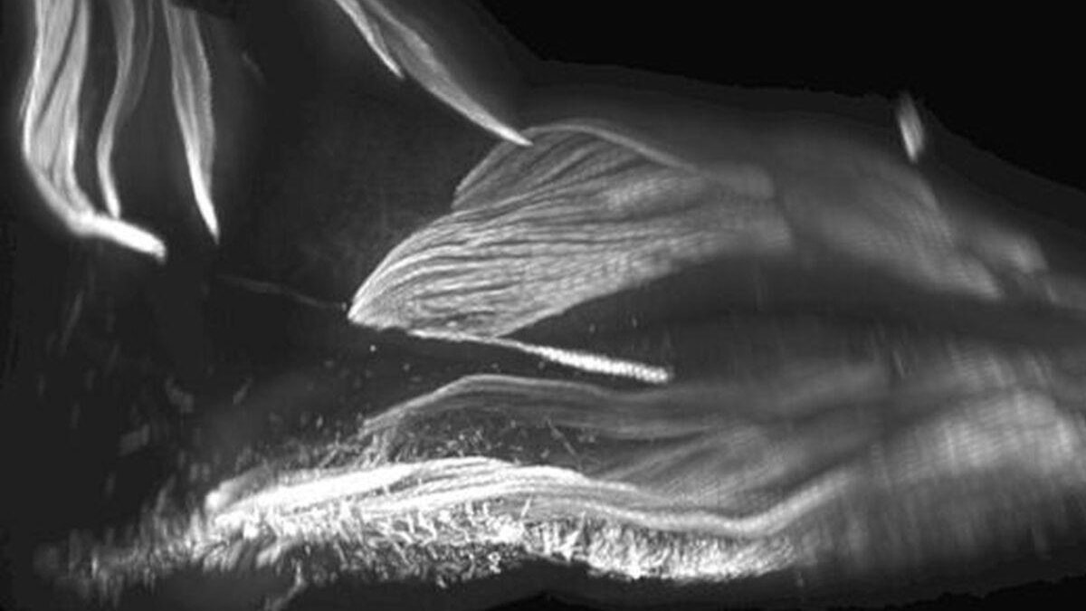 Foi possível observar um músculo diferente nos dedos das mãos - reprodução / G1