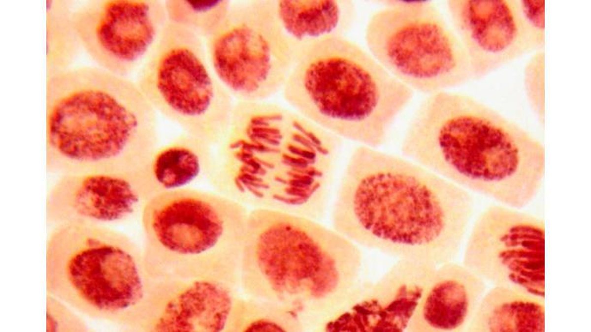 Abortos recorrentes podem ser causados falta de células tronco no endométrio, diz estudo - Shutterstock