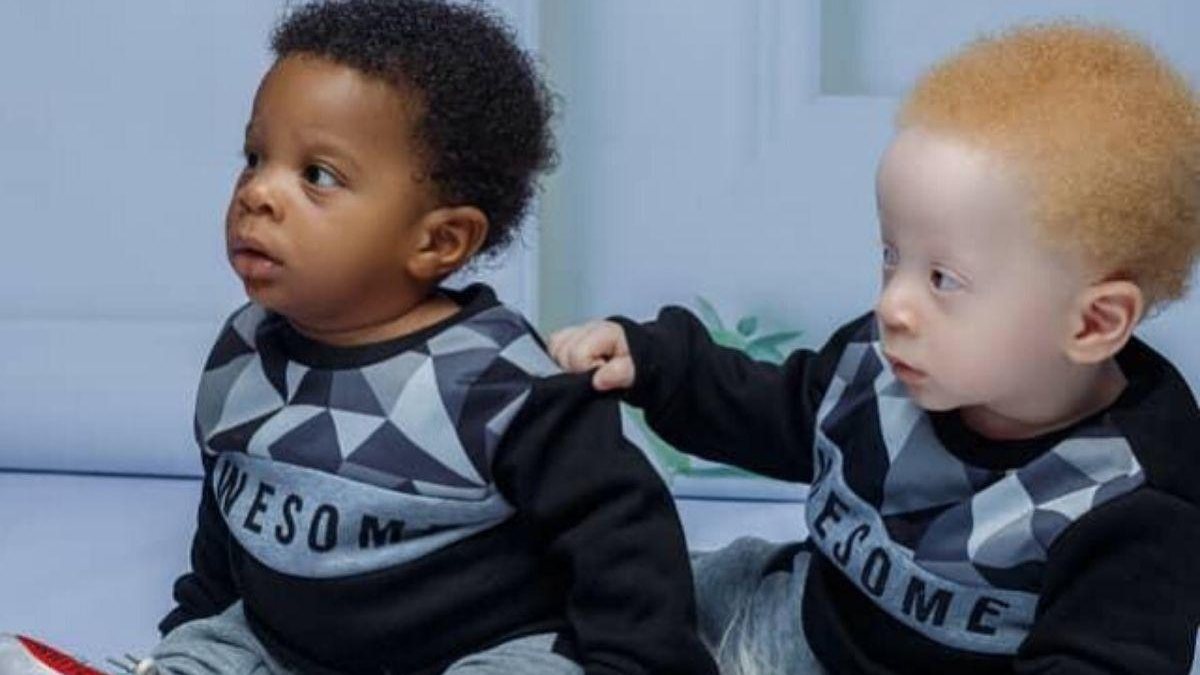 Mãe relata como é ter gêmeos, com cores de pele diferente (Foto: Reprodução/ Instagram 