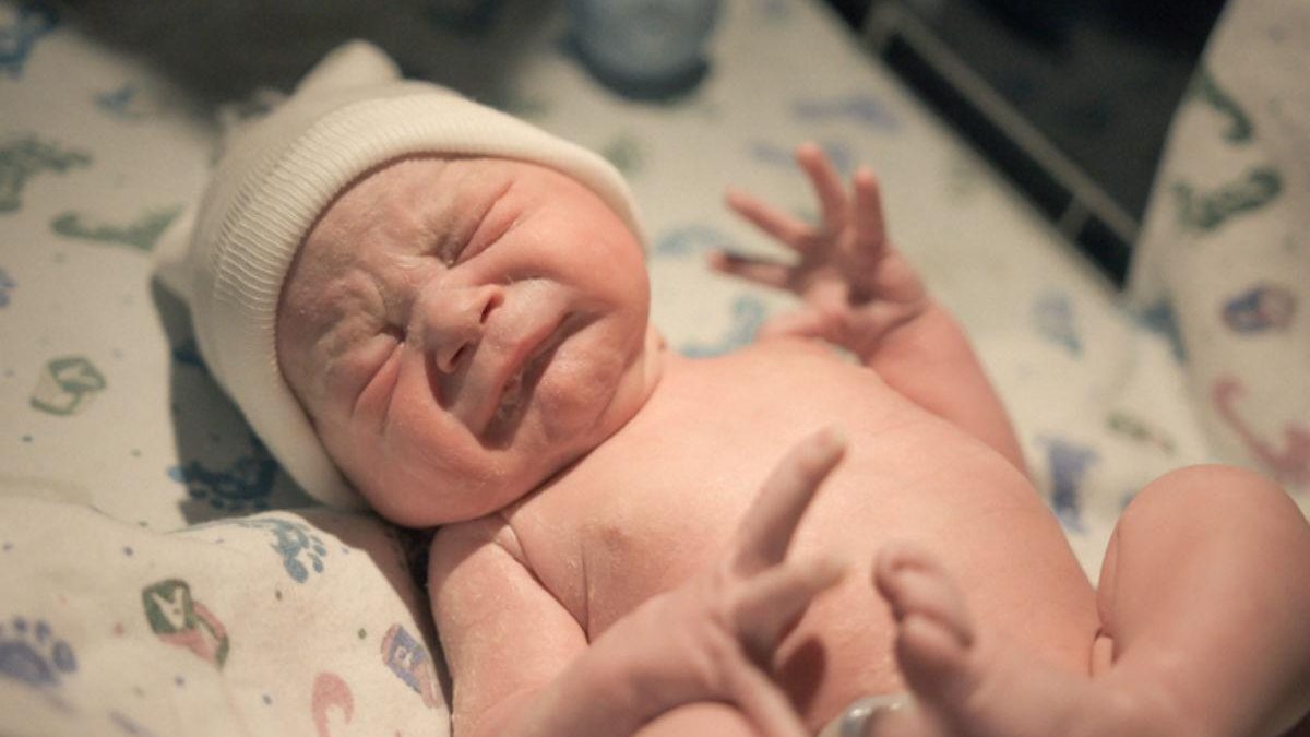 Bebê que nasceu com cauda teve a estrutura retirada quando completou 2 meses de idade - Getty Images