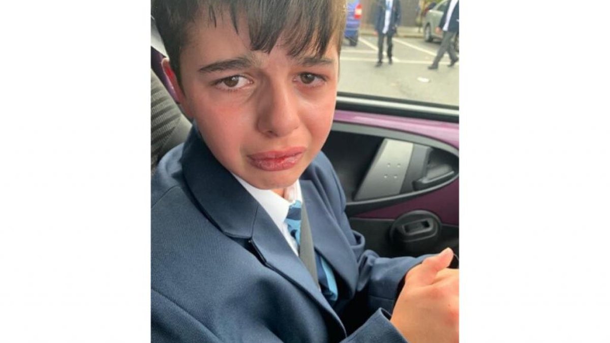 Garoto de 12 anos chora diariamente após sofrer bullying - Reprodução / Facebook