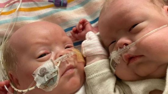 Os gêmeos prematuros nasceram com 5 meses de gestação e precisaram passar por 6 cirurgias e 25 transfusões de sangue - Reprodução/BBC