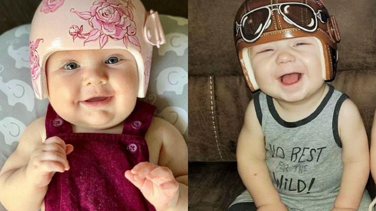 Artista transforma capacetes usados ​​por bebês com síndrome em arte - reprodução Parents / Pinterest