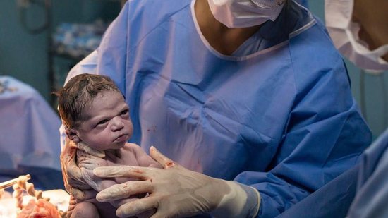 Rodrigo registrou as fotos do parto da “bebê brava” - Reprodução/ Instagram/ @rodrigokunstmann