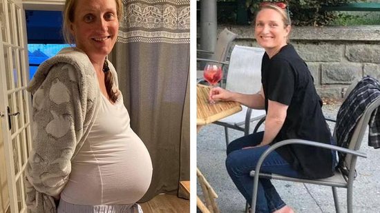 Ela acabou perdendo doze quilos durante a gravidez devido à condição - reprodução Daily Mail