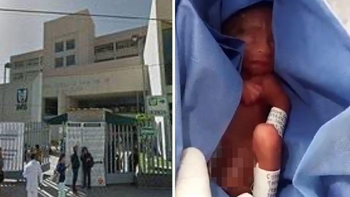 Os médicos ficaram chocados ao perceber que o bebê estava vivo - Reprodução / DailyMail