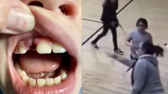 Vídeo: Professora quebra dente dente de criança com taco de hóquei - Reprodução/Instagram