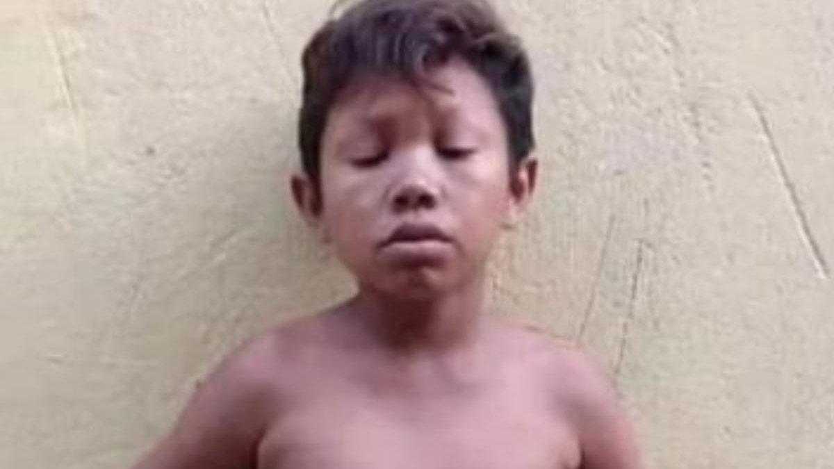 Homem de 20 anos com aparência de criança de 5 anos é morto a tiros no Pará - reprodução G1